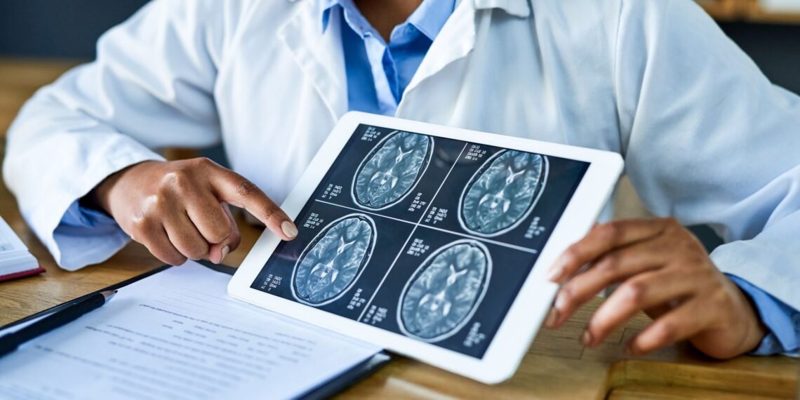 Oncologista a Kalil: Incidência de tumor cerebral não é alta, mas assusta
