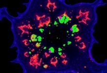 CAP’s Role in Osteosarcoma’s Temperature Regulation Revealed